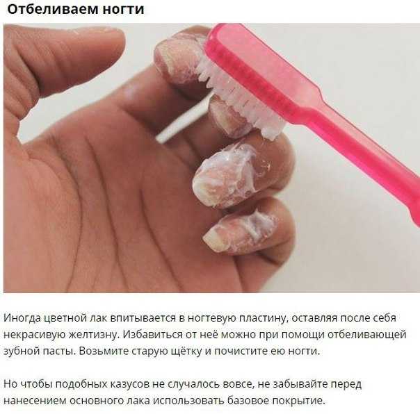 Уход за руками после огорода. чем можно отмыть, отбелить и привести в порядок руки?