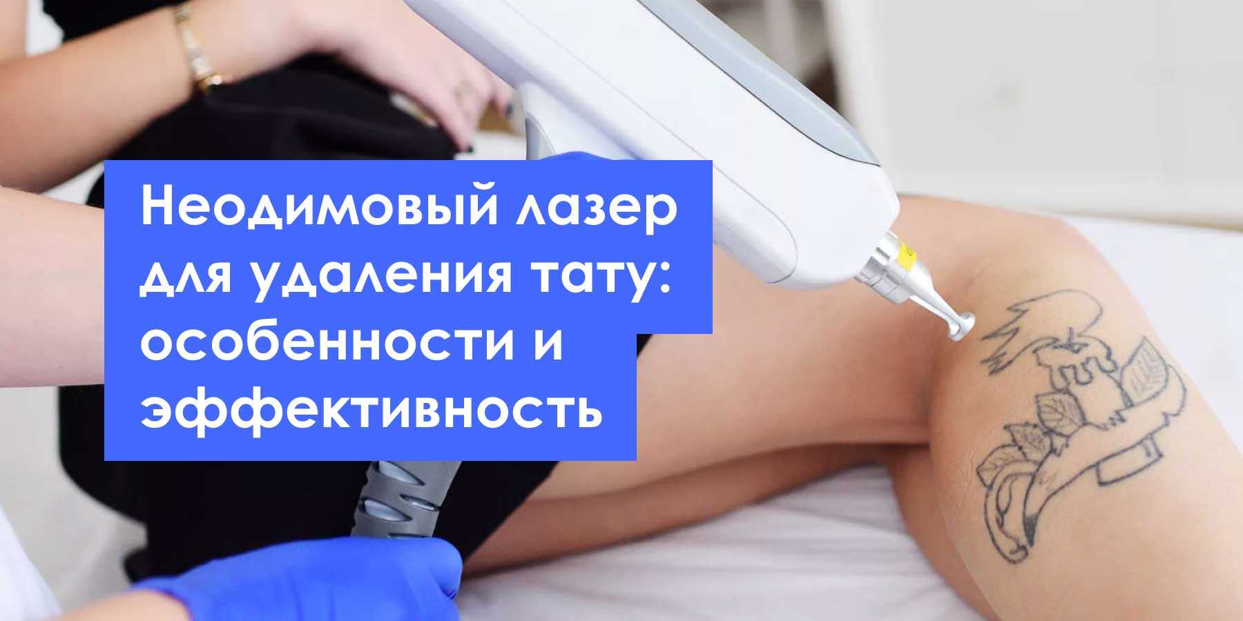 Удаление тату лазером: отзывы, фото до и после