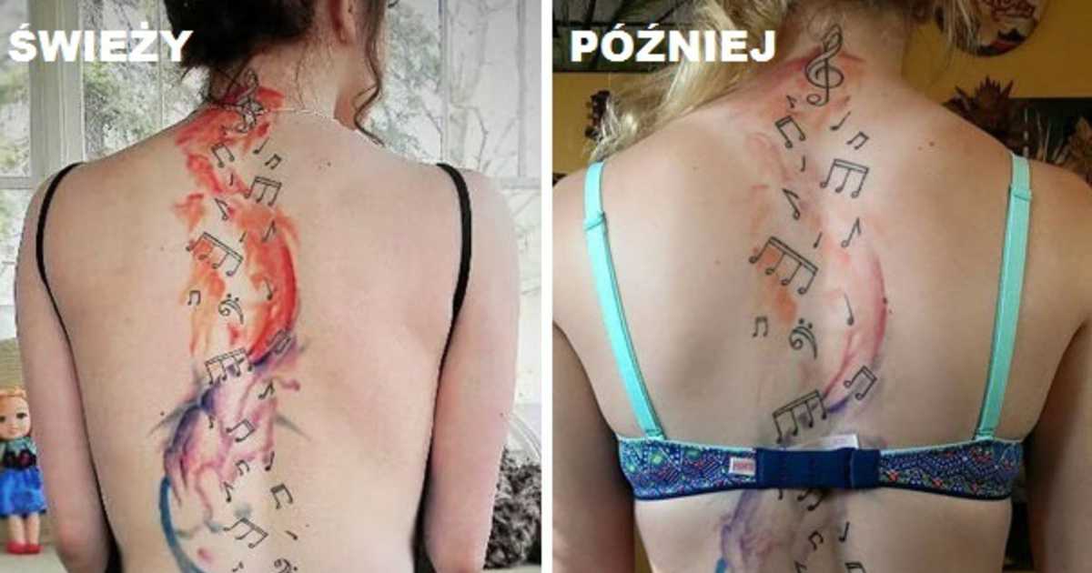 Заболевания после татуировок - tatpix.ru