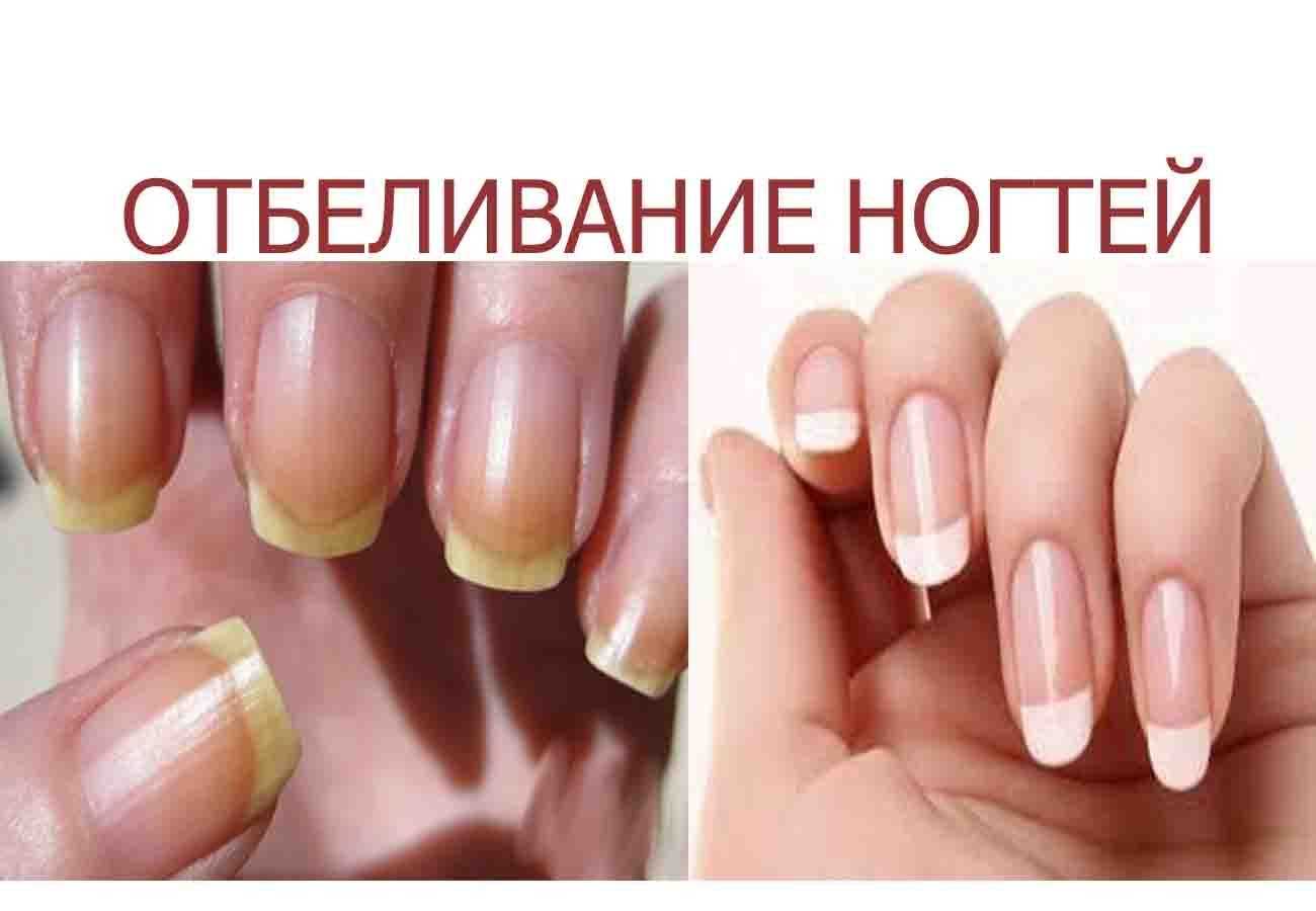 8 натуральных средств осветлить кожу в домашних условиях