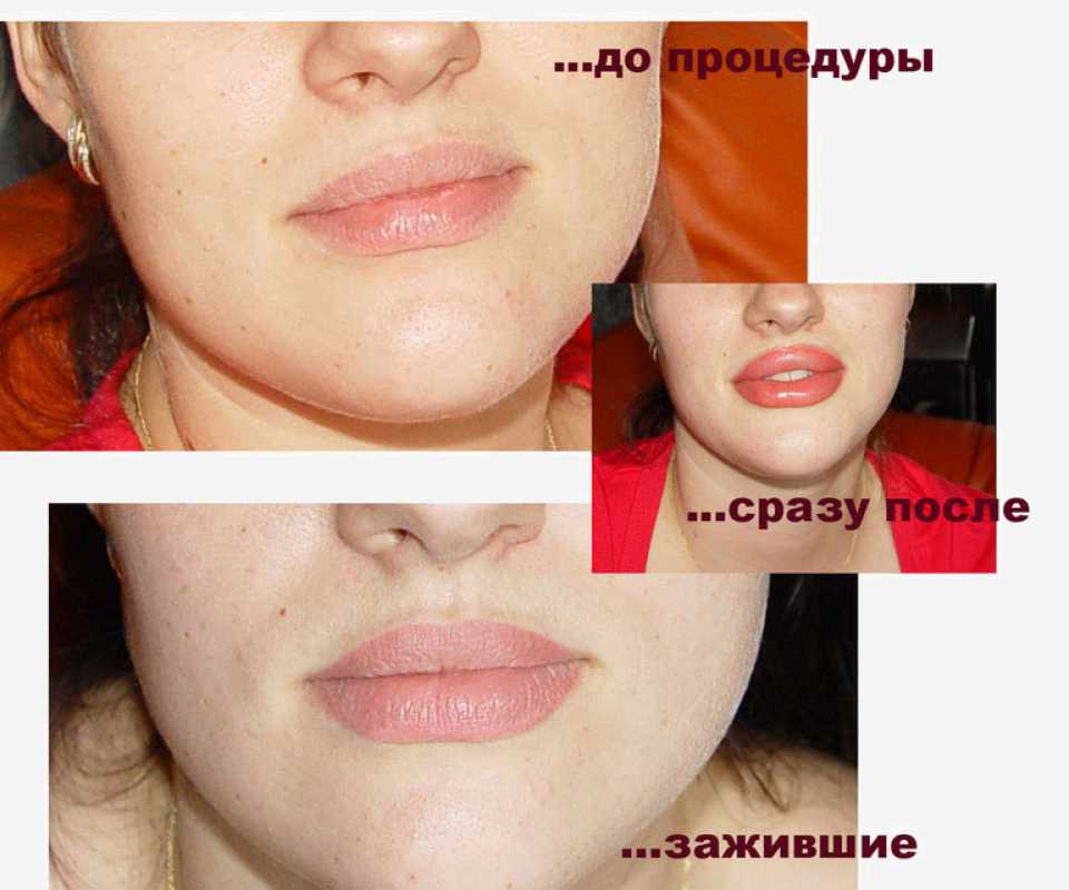 Фото до и после нанесения перманентного макияжа губ